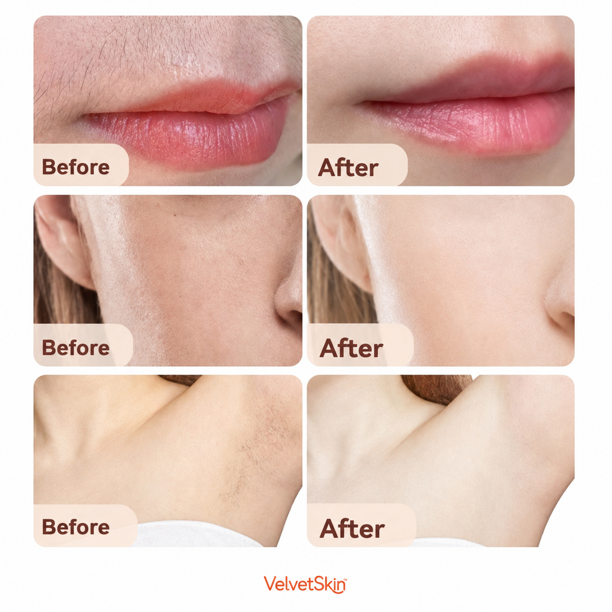 VelvetSkin™ - Depilación facial